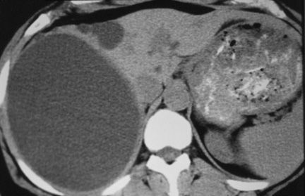 Nang gan - Hình ảnh minh họa